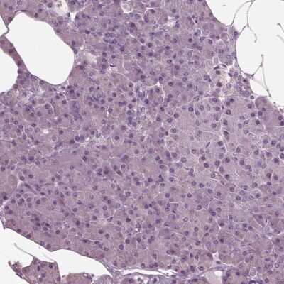 Immunohistochemistry-Paraffin: CLCN4 Antibody [NBP1-84452]