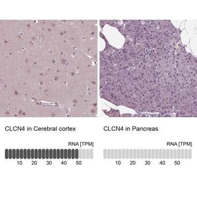 Immunohistochemistry-Paraffin: CLCN4 Antibody [NBP1-84452]