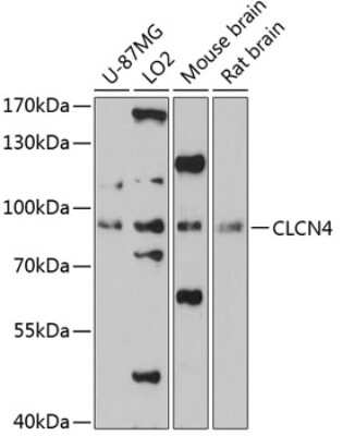 Western Blot: CLCN4 AntibodyAzide and BSA Free [NBP2-92128]