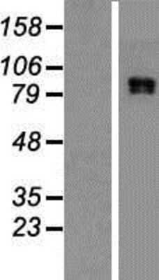 Western Blot: CLCN4 Overexpression Lysate [NBP2-08174]