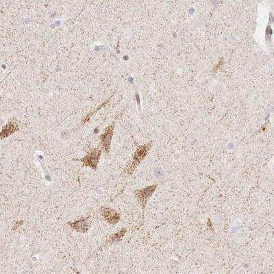 Immunohistochemistry-Paraffin: CLCN5 Antibody [NBP1-84451]