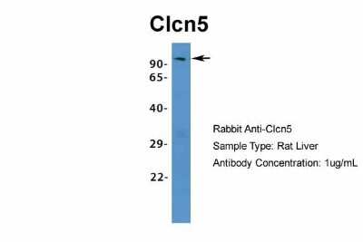 Western Blot: CLCN5 Antibody [NBP1-69123]