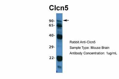 Western Blot: CLCN5 Antibody [NBP1-69123]