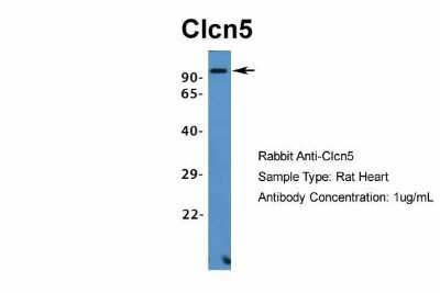 Western Blot: CLCN5 Antibody [NBP1-69123]
