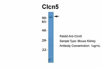 Western Blot: CLCN5 Antibody [NBP1-69123]