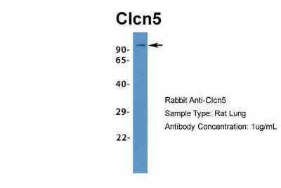 Western Blot: CLCN5 Antibody [NBP1-69123]