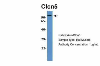 Western Blot: CLCN5 Antibody [NBP1-69123]