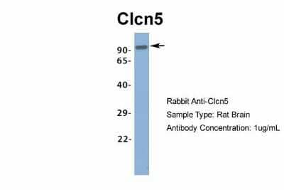 Western Blot: CLCN5 Antibody [NBP1-69123]