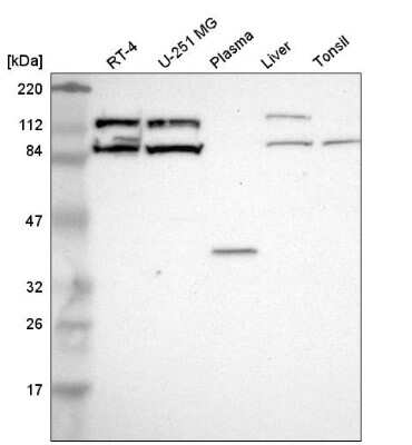 Western Blot: CLCN5 Antibody [NBP2-58621]