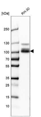 Western Blot: CLCN5 Antibody [NBP2-58621]
