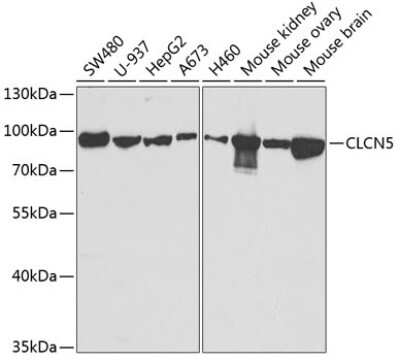 Western Blot: CLCN5 AntibodyBSA Free [NBP2-92656]