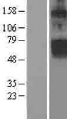 Western Blot: CLCN5 Overexpression Lysate [NBL1-09234]