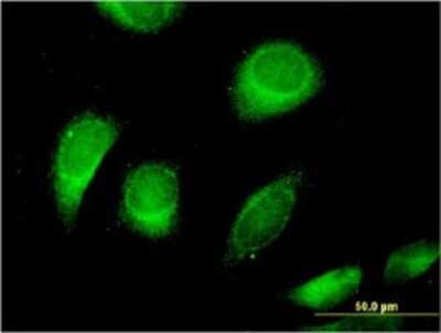 Immunocytochemistry/ Immunofluorescence: CLCN6 Antibody (2H2) [H00001185-M05]