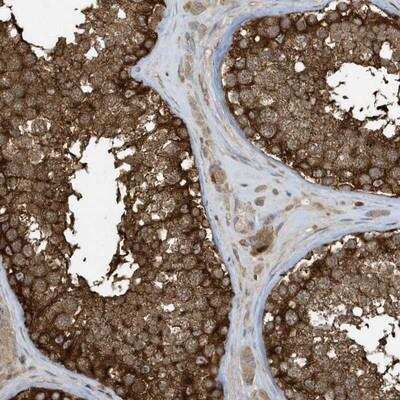 Immunohistochemistry-Paraffin: CLCN6 Antibody [NBP1-85583]