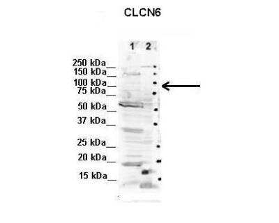 Western Blot: CLCN6 Antibody [NBP2-84690]