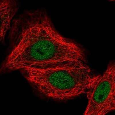 Immunocytochemistry/ Immunofluorescence: CLCN7 Antibody [NBP1-91791]