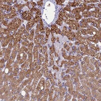 Immunohistochemistry-Paraffin: CLCN7 Antibody [NBP1-91792]