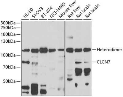 Western Blot: CLCN7 AntibodyBSA Free [NBP2-92800]