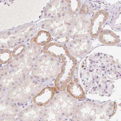 Immunohistochemistry: CLCNKA Antibody [NBP2-46842]