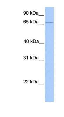 Western Blot: CLCNKA Antibody [NBP1-80067]