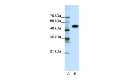 Western Blot: CLCNKB Antibody [NBP3-10348]