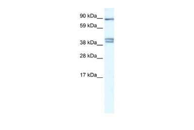 Western Blot: CLCNKB Antibody [NBP3-10349]