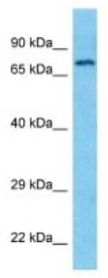 Western Blot: CLCNKB Antibody [NBP3-10791]