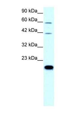 Western Blot: Claudin-23 Antibody [NBP1-70500]