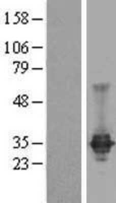 Western Blot: Claudin-23 Overexpression Lysate [NBP2-04756]