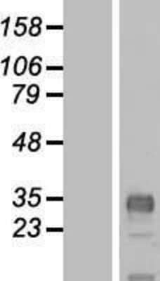 Western Blot: CLDND1 Overexpression Lysate [NBL1-09252]