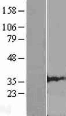 Western Blot: CLDND1 Overexpression Lysate [NBL1-09253]