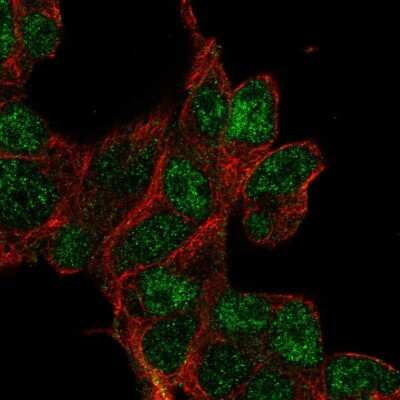 Immunocytochemistry/ Immunofluorescence: CLDND2 Antibody [NBP2-30766]