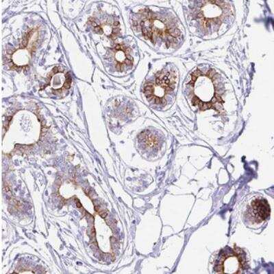 Immunohistochemistry-Paraffin: CLDND2 Antibody [NBP2-30766]