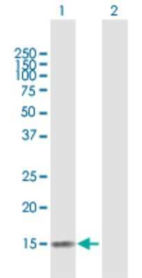 Western Blot: CLDND2 Antibody [H00125875-B01P]