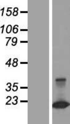 Western Blot: CLDND2 Overexpression Lysate [NBP2-05392]