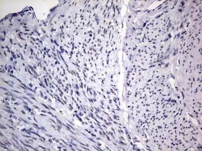 Immunohistochemistry: CLE7 homolog Antibody (OTI2A4) - Azide and BSA Free [NBP2-71940]