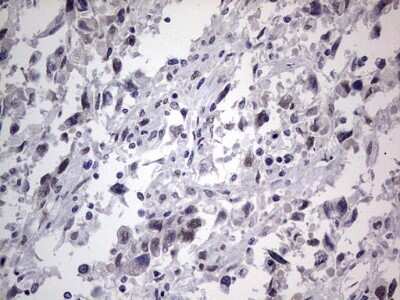 Immunohistochemistry: CLE7 homolog Antibody (OTI2A4) - Azide and BSA Free [NBP2-71940]