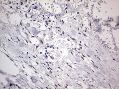 Immunohistochemistry: CLE7 homolog Antibody (OTI2A4) - Azide and BSA Free [NBP2-71940]