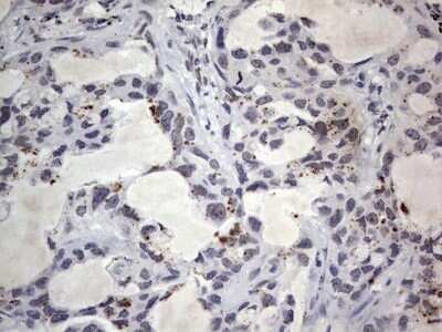 Immunohistochemistry: CLE7 homolog Antibody (OTI2A4) - Azide and BSA Free [NBP2-71940]