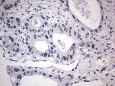 Immunohistochemistry: CLE7 homolog Antibody (OTI2A4) - Azide and BSA Free [NBP2-71940]
