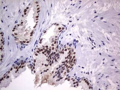 Immunohistochemistry: CLE7 homolog Antibody (OTI2A4) - Azide and BSA Free [NBP2-71940]