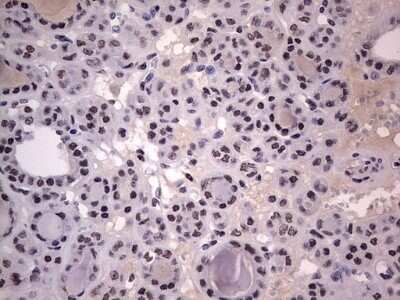 Immunohistochemistry: CLE7 homolog Antibody (OTI2A4) - Azide and BSA Free [NBP2-71940]