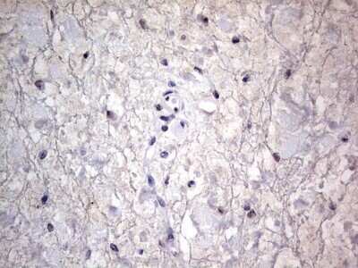 Immunohistochemistry: CLE7 homolog Antibody (OTI2A4) - Azide and BSA Free [NBP2-71940]
