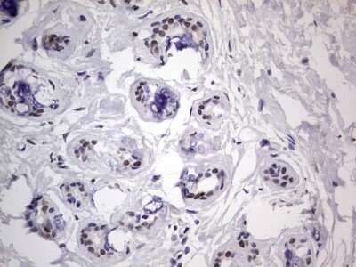 Immunohistochemistry: CLE7 homolog Antibody (OTI2A4) - Azide and BSA Free [NBP2-71940]
