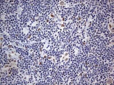 Immunohistochemistry: CLE7 homolog Antibody (OTI2A4) - Azide and BSA Free [NBP2-71940]