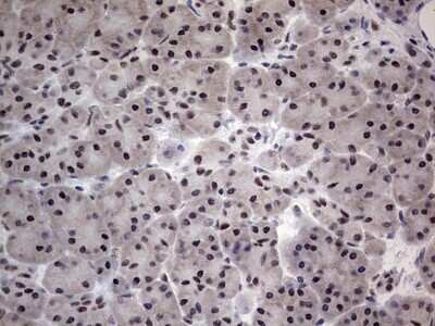 Immunohistochemistry: CLE7 homolog Antibody (OTI2A4) - Azide and BSA Free [NBP2-71940]