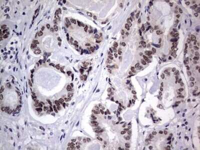 Immunohistochemistry: CLE7 homolog Antibody (OTI2A4) - Azide and BSA Free [NBP2-71940]