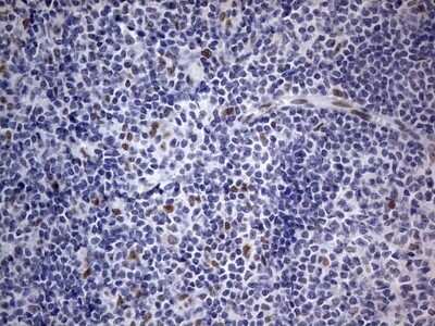 Immunohistochemistry: CLE7 homolog Antibody (OTI2A4) - Azide and BSA Free [NBP2-71940]