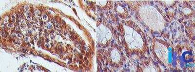 Immunohistochemistry-Paraffin: CLEC-1 Antibody [NBP2-22382]