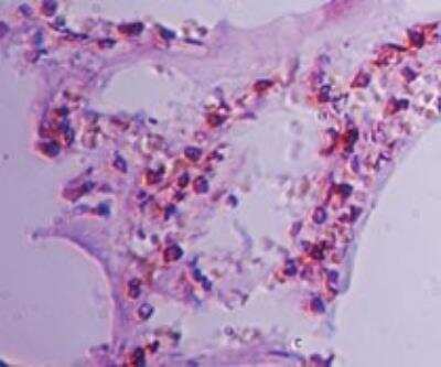 Immunohistochemistry-Paraffin: CLEC-1 Antibody [NBP2-27096]